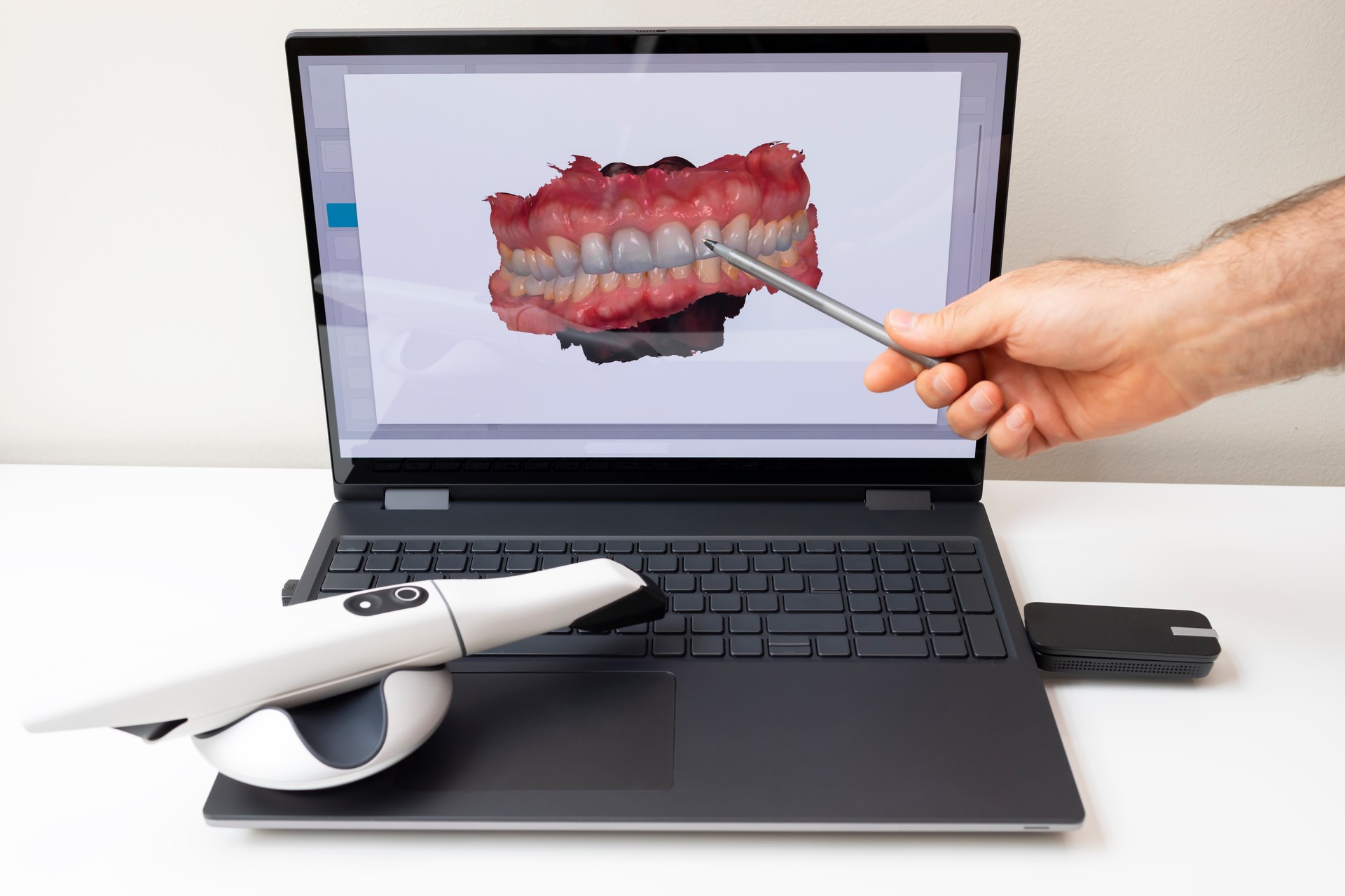 Dentist Shows 3D Scanned Picture of Scanned Teeth on Monitor of Computer. White 3d Intraoral Dental Tooth Scanner Lying on Table. Dental Equipment, Device For Scanning Teeth. Dentistry. Horizontal